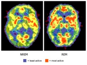 nrem_rem_brain_activity